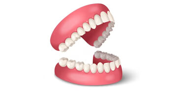 Open dentures model showing upper and lower false teeth with pink gums on white background.