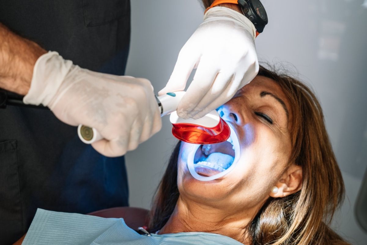 Professional teeth whitening treatment