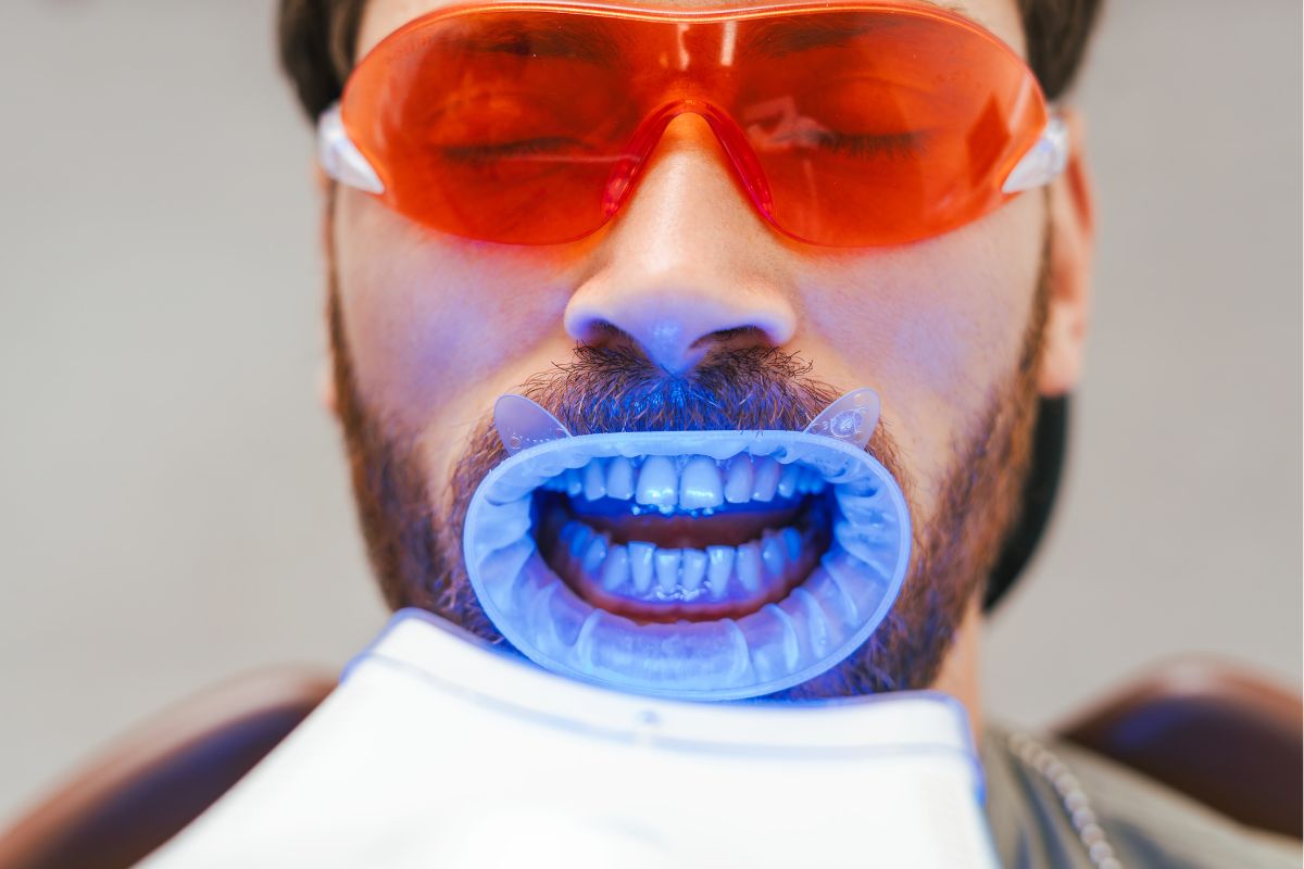 Is Teeth Whitening Safe for Sensitive Teeth?