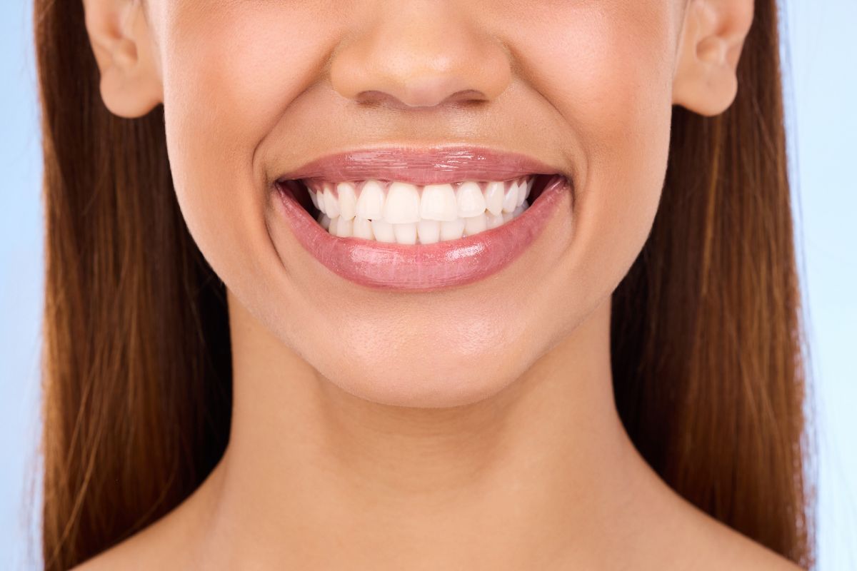 How Often Should You Whiten Your Teeth?