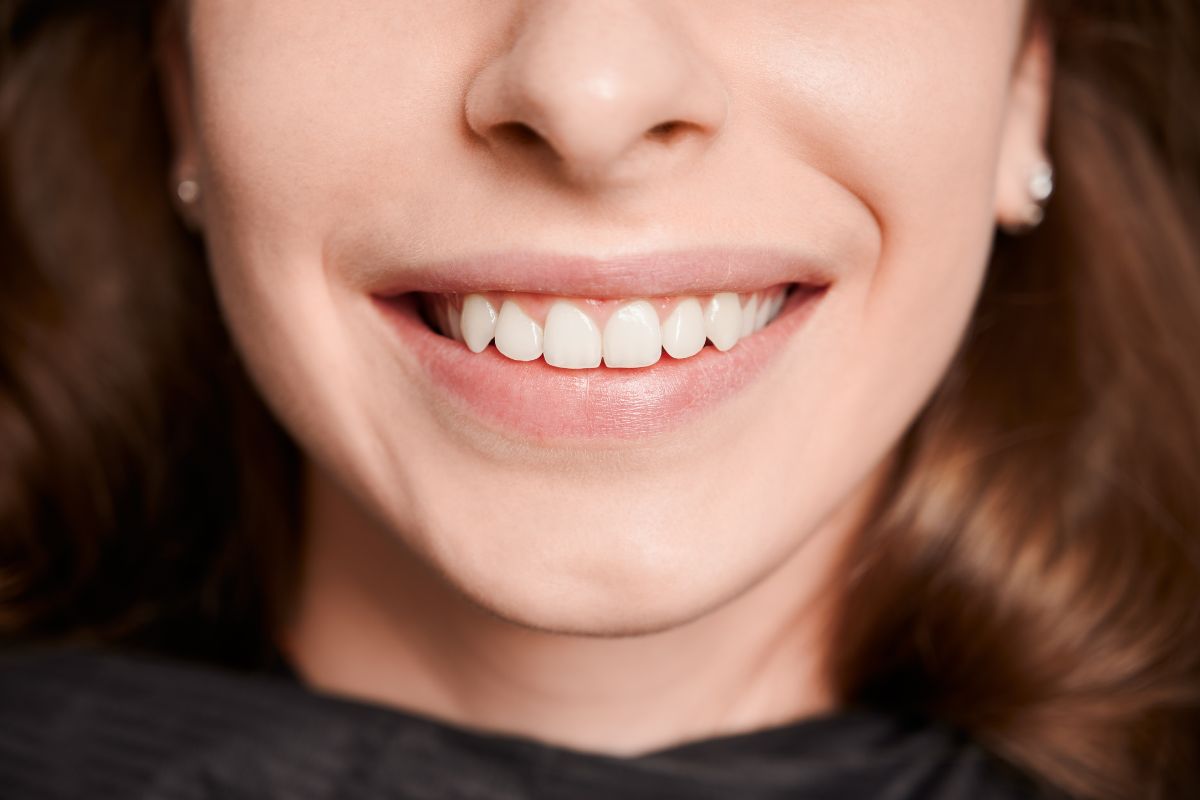 Uneven Front Teeth? What You Can Do to Improve Your Smile