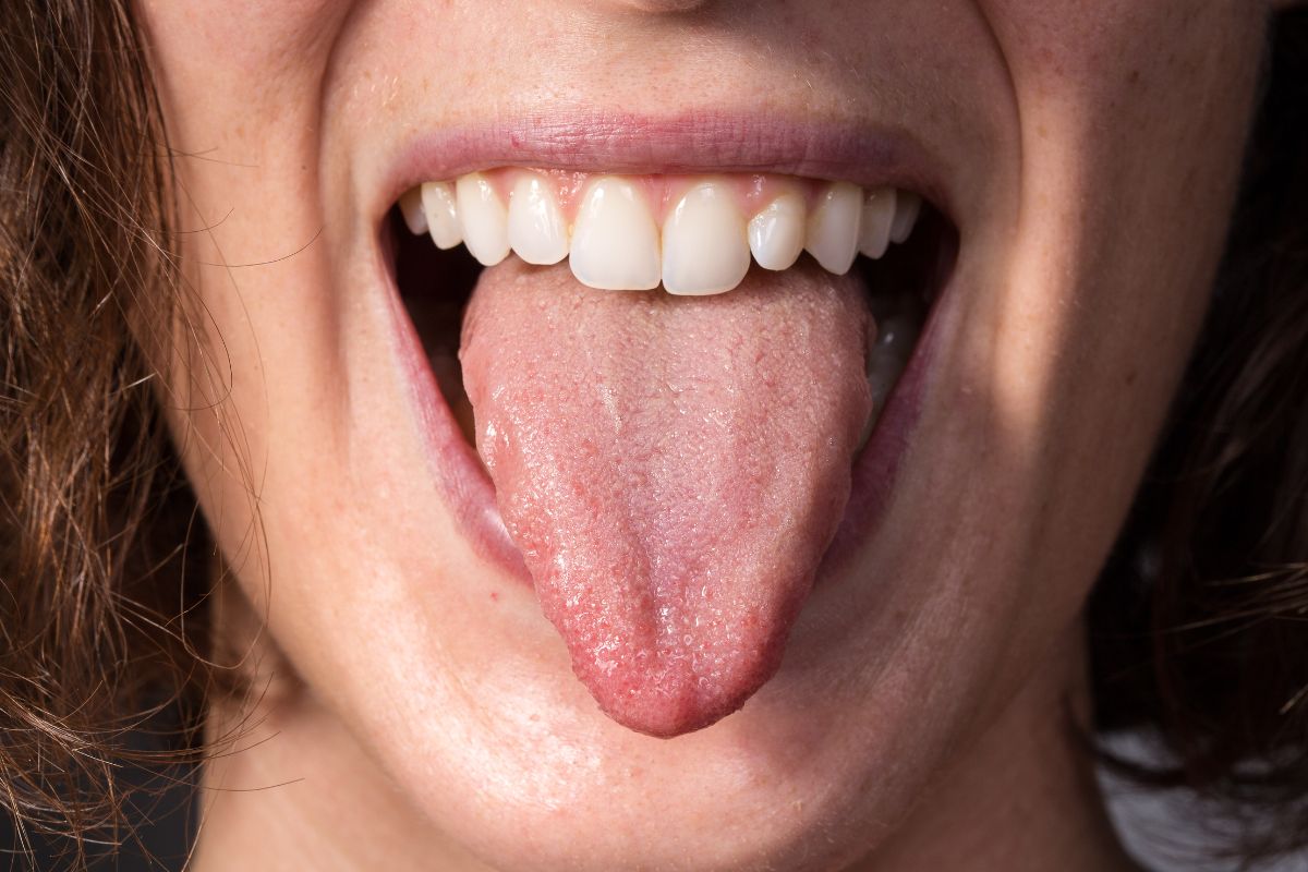 Why Do I Keep Getting Bumps on My Tongue?